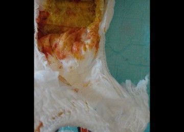 Seputar pup bayi 8 bulan