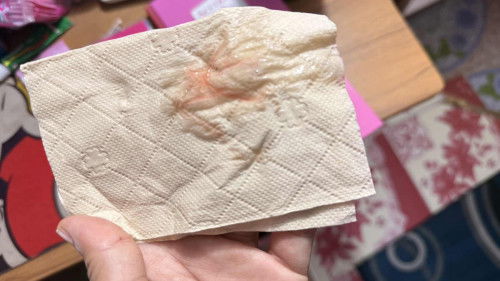 มีมูกเลือดออก