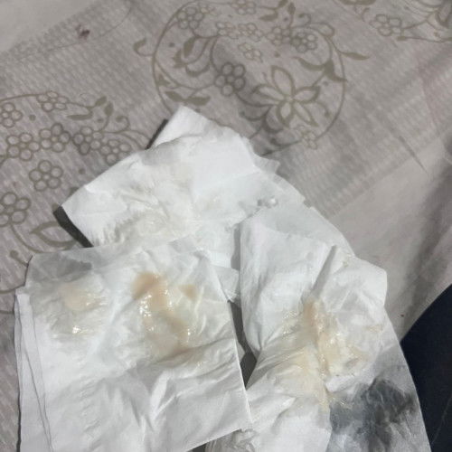 Ini keputihan atau flek ya?