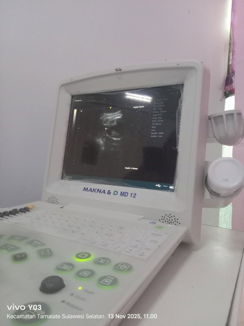 Naikin bb janin