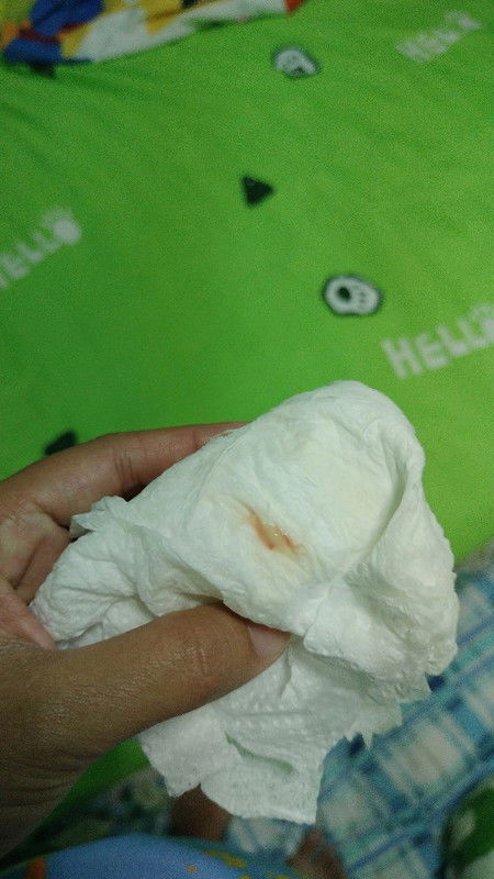 แบบนี้คือใกล้คลอดแล้วหรือยังคะ