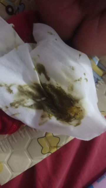 Mau tanya nih bun soal pup bayi