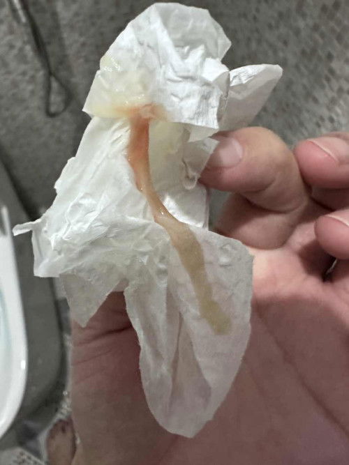 Discharge with blood