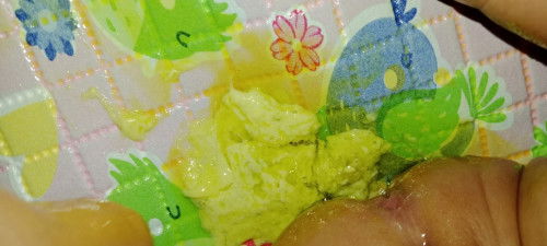 Ini normal aja kah bund?