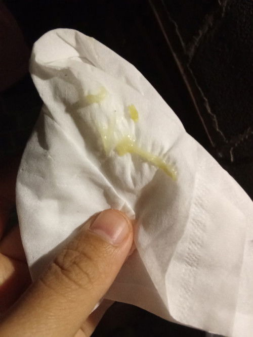 มีแบบนี้ออกมาคืออะไร?!