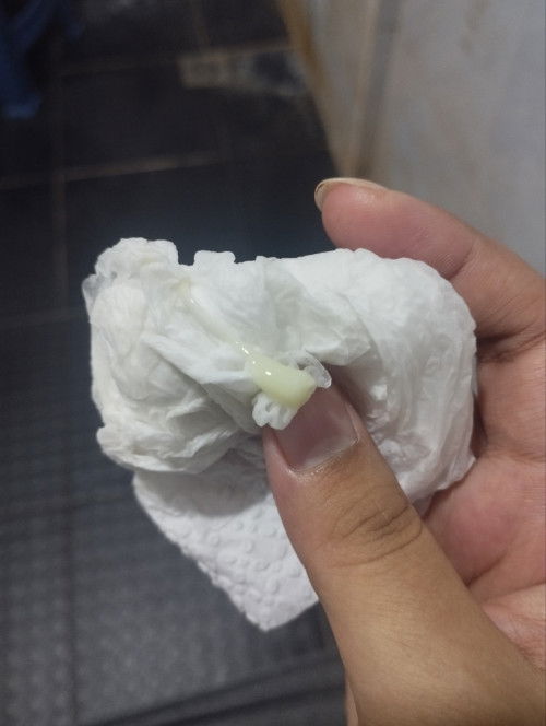 มูกหรือตกขาวคะ 37+4 week ค่ะ