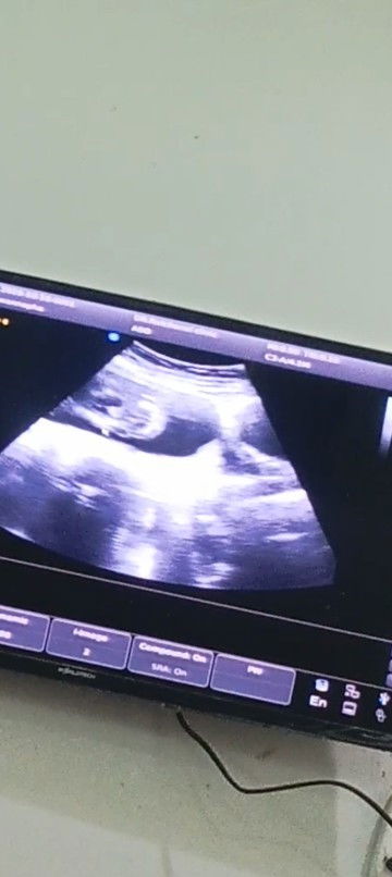 อันตร้าซาวตอน 17วีค