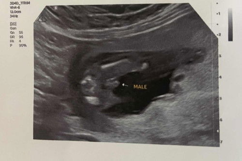 เพศไหนๆ แม่ๆช่วยดูหน่อย