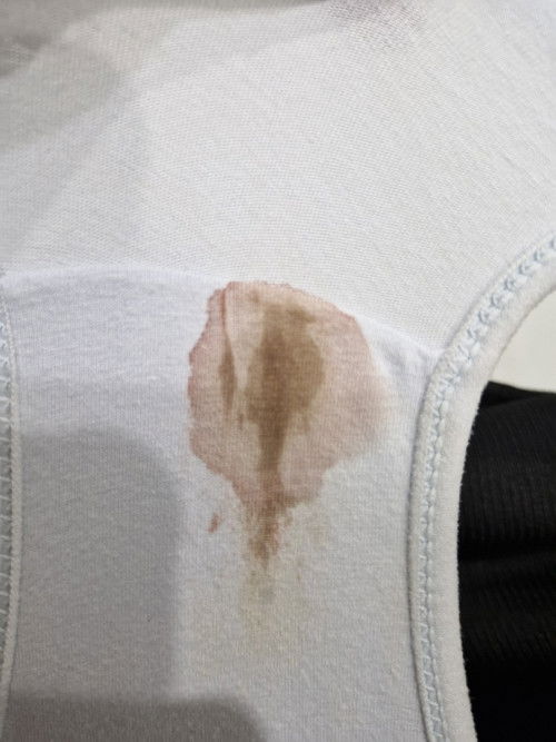 ท้องได้ 8 วีค