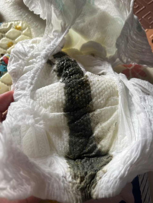 น้อง3เดือนถ่ายสีดำปนเหลืองมีเม็ด