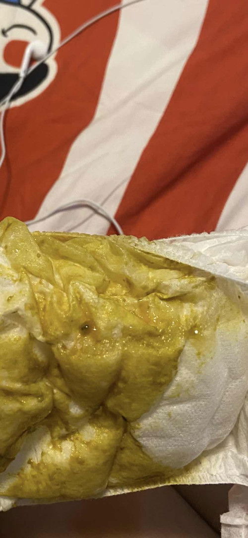 อันนี้ใช่มูกเลือดมั้ยคะ