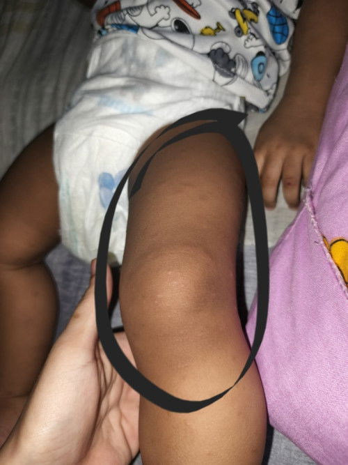 Pa sagot naman ako mga mi wala pa kasi pang check up