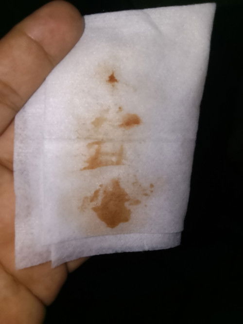 39 weeks and 4 days na