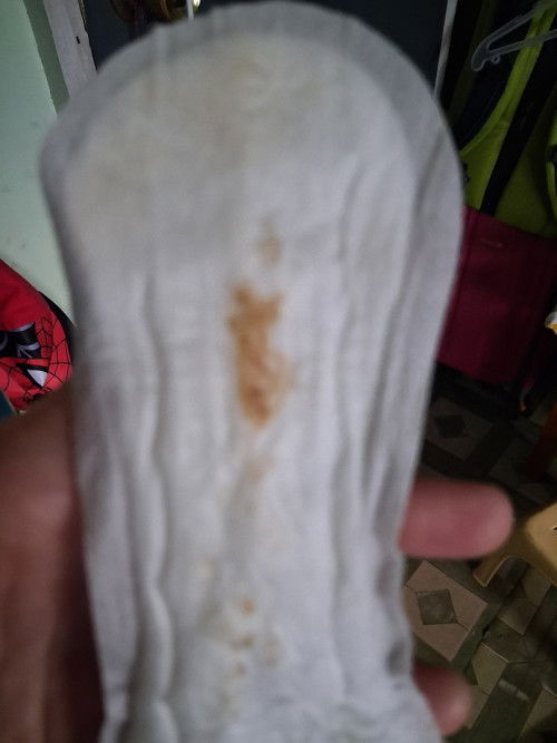 Hello mga mommies, nakaranas ba kayu ng ganito nasa 7 weeks pa ang aking tiyan, at nagtake ng vitami