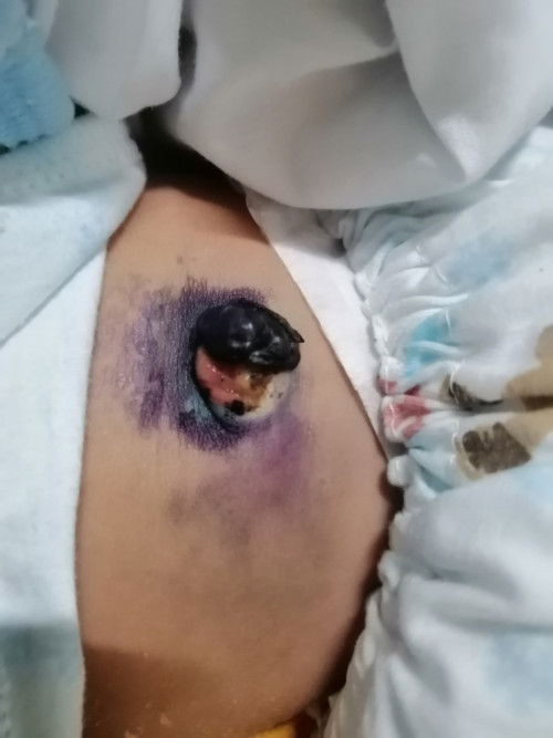 สะดือปกติมัั้ย