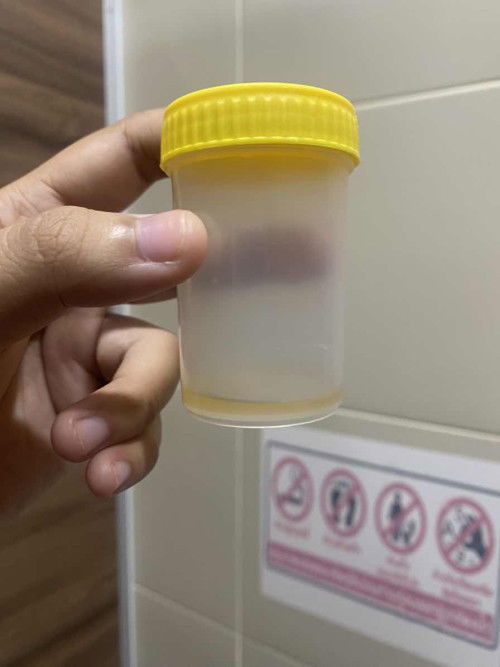 ฉี่ออกน้อย เป็นอะไรมั้ยคะ