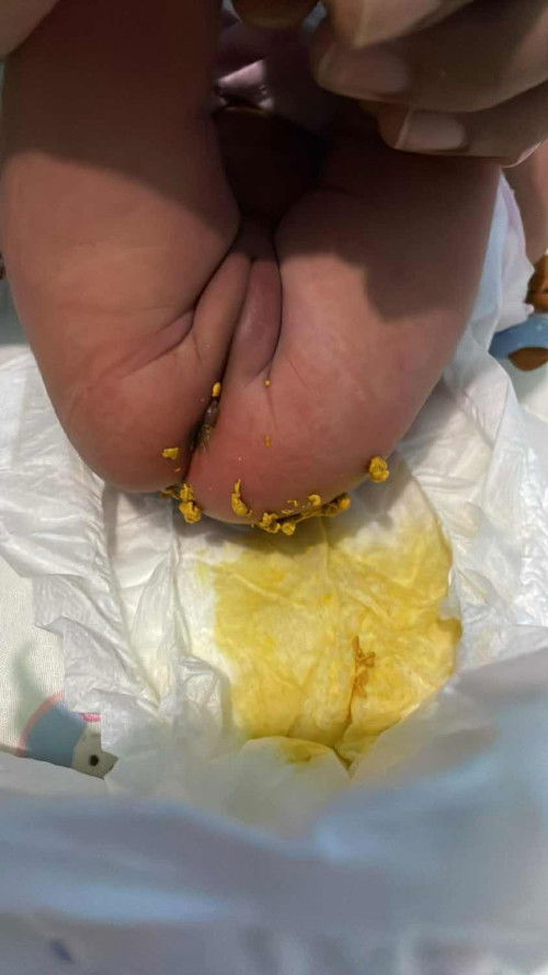 ขออนุญาตสอบถามคะ