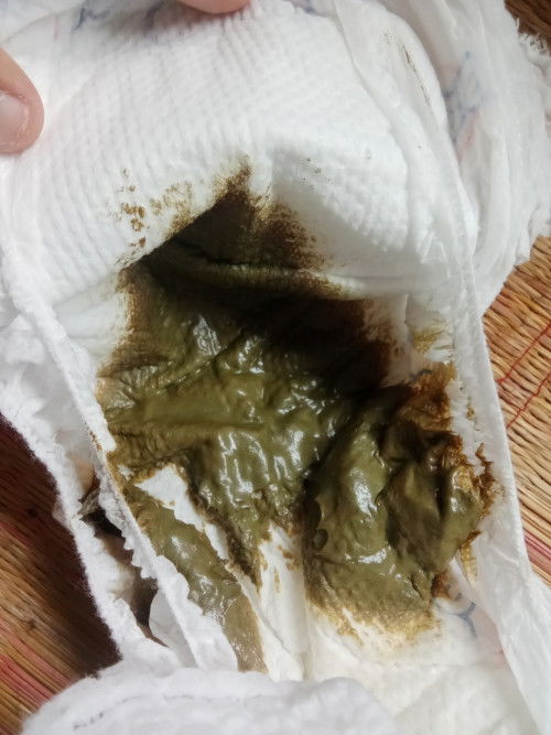 อึลูกเป็นสีเขียวเข้ม