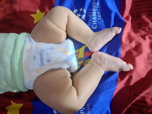 Kaki kanan lebih besar dibanding kiri