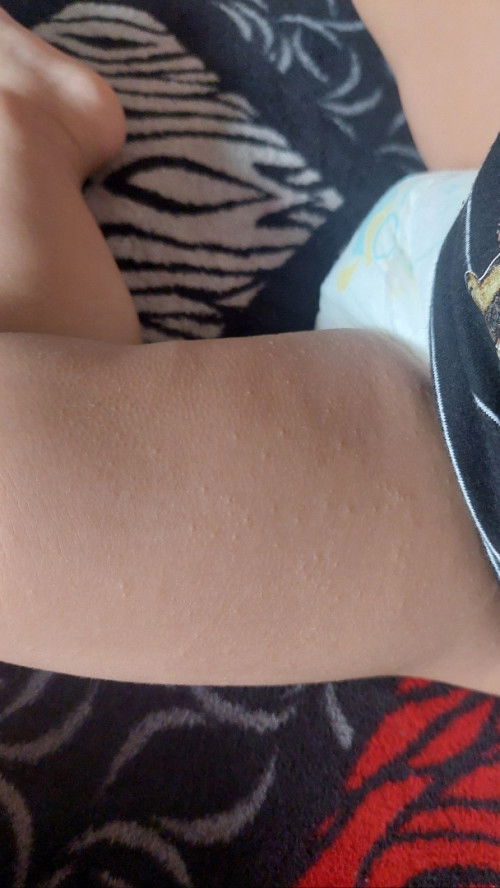 Kiramya ada yang mengalami hal yang sama