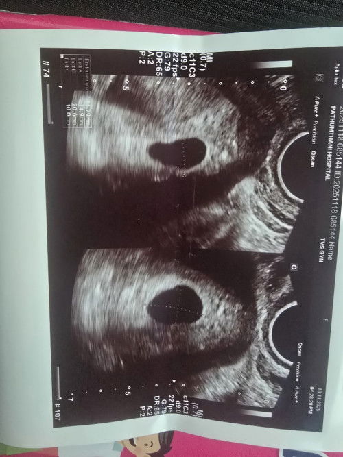 แบบนี้มีโอกาสเจอน้องไหมคะ