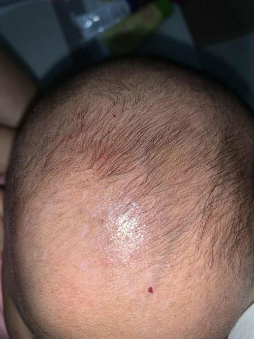 bayi suka garuk kepala