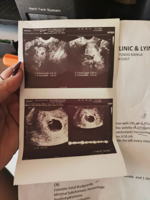 1st Time mom at age 29