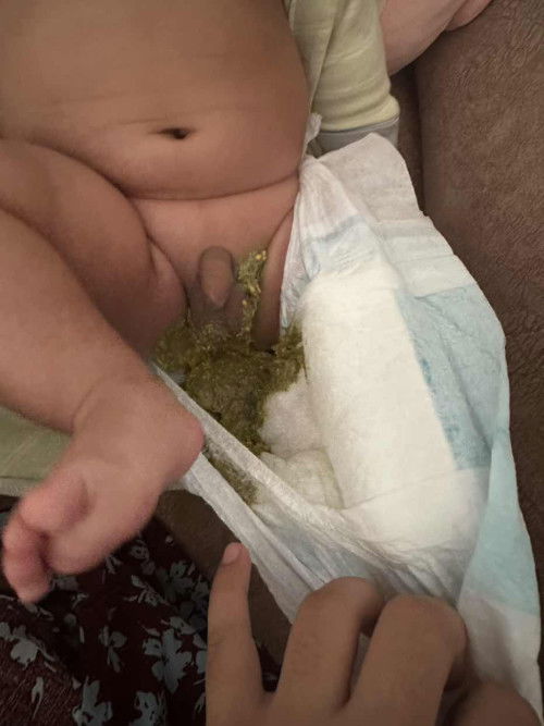 Normal ke najis wrna ni?