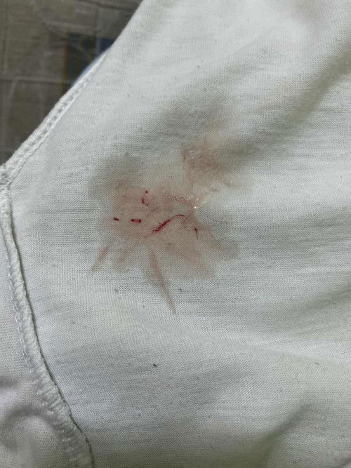 38 weeks
Adakah ini tanda tanda bersalin.. tapi belum rasa sakit..cuma sakit pinggang je