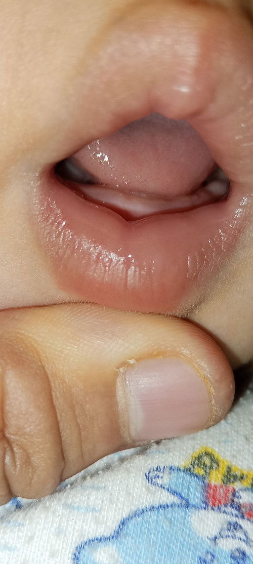 ลูกบ้านแม่ๆฟันขึ้นตอนกี่เดือนคะ