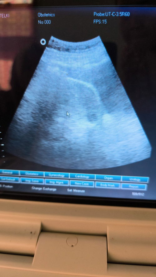 Kiranya ada udah ada kantong ny blm ya