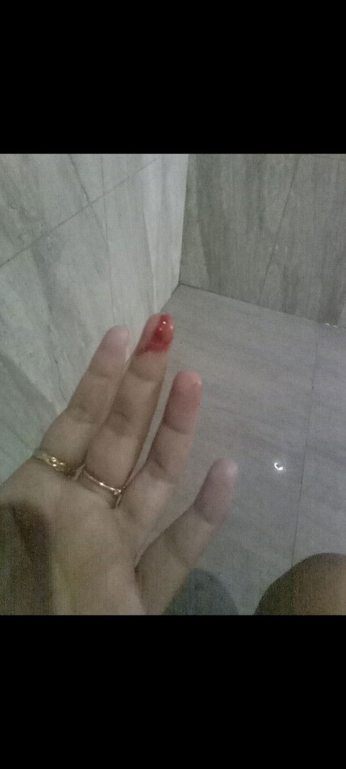 Adakah yang seperrti sayaa flek dari kemaren tapi perut biasa saja tidak sakit. .