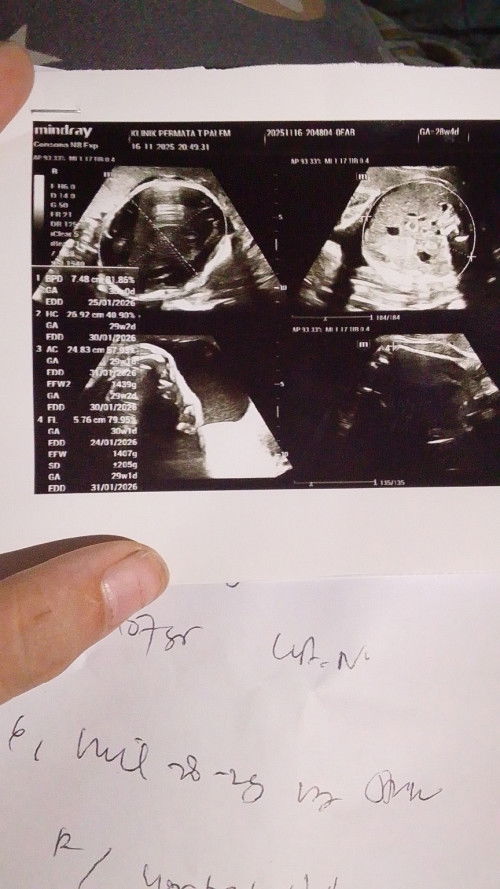 Usia 29 week pas USG 2D dokter nya tidak menjelaskan cuman  saya kurang mengerti Bun ada yang tau?🙏