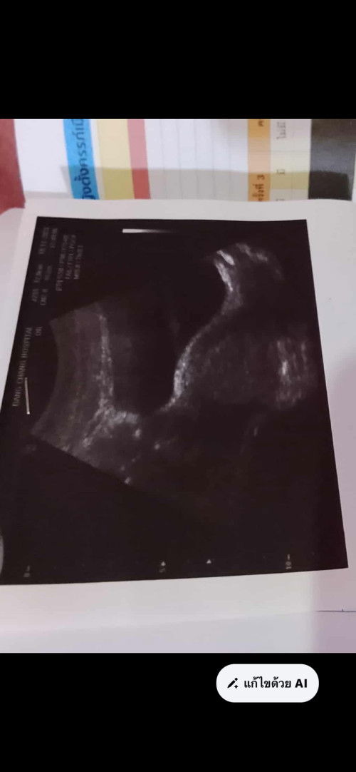 ตั้งครรภ์ 6สัปดาห์1วัน