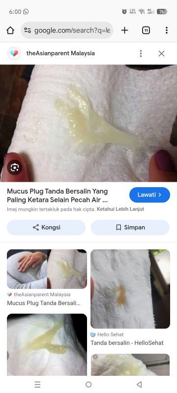adakah ini tanda persalinan sdh dekat?