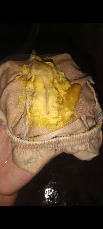 Pup ambyar anak 14bulan