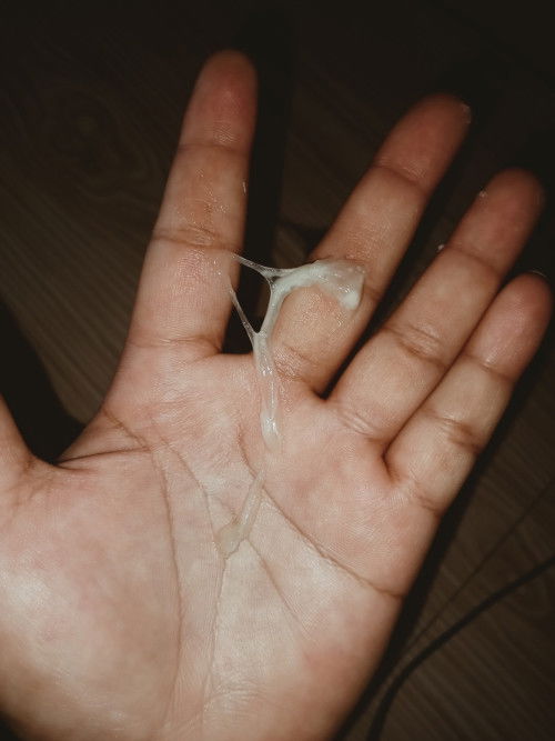 ท้อง36+3ใช่มูกไหมคะ