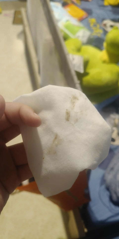 ถามหน่อยคะแม่ๆ แบบนี้มูกเลือดใหมมันออกสีน้ำตาลๆ พอดีเมื่อเช้าไปตามหมอนัดเปิด2เซน กับมาบ้านมีออกแบบนี