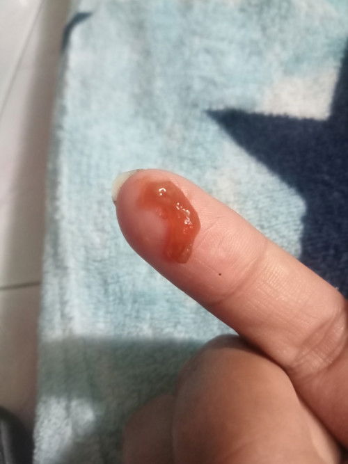 Bunda mau tanya ini lendir apa ya bun sya hamil 24 Minggu Bun keluar cairan ini di CD Miss v basah