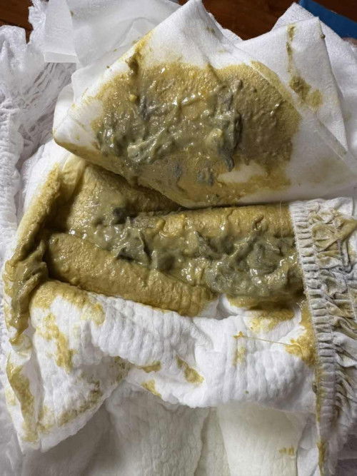 สีอึแบบนี้ปกติมั้ยค่ะ