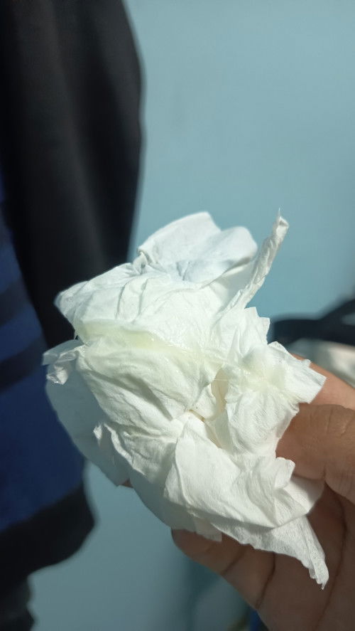 แบบนี้ใช่มูกไหมคะ หรือ ตกขาว