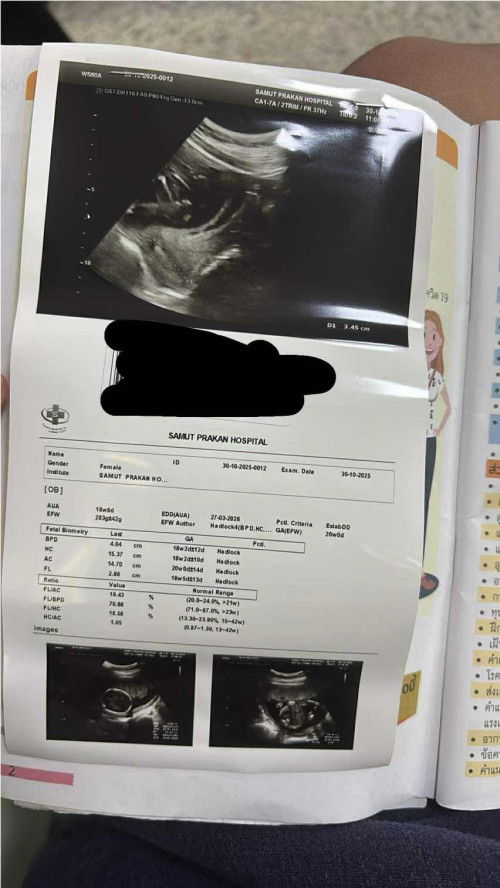 ขออนุญาตสอบถามค่ะ