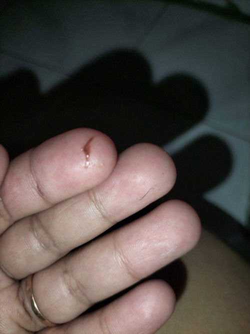 Maaf sebelumnya jorok ... ini TM 1 5week kalau dicolek ada lendir coklat mudah ..kenapa ya?