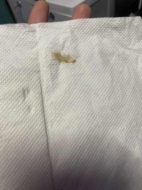 37 weeks วันนี้โดนตรวจปากมดลูกมา