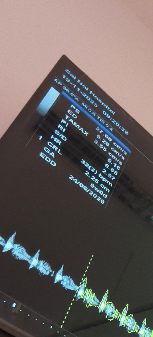 อัลตร้าซาวด์