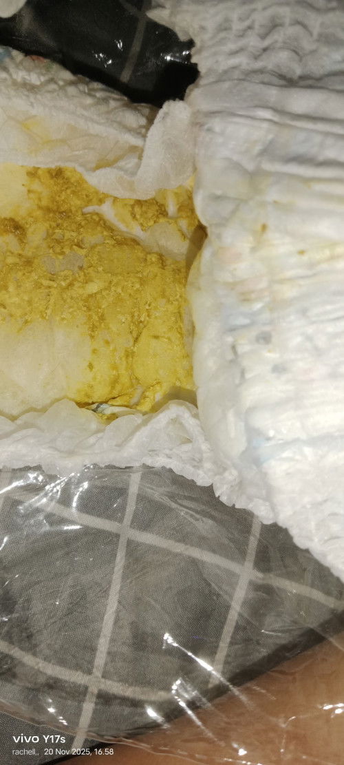 Maaf bunda mau tanya bayi umur 3bulan bab nya kaya gto itu kira² diare apa normal ya asi mix sufor .