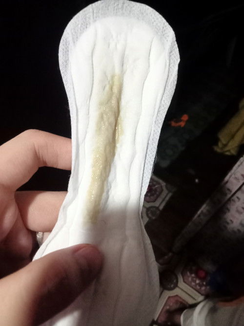 1month na Po aku naka panganak , anu Po kaya ito ?