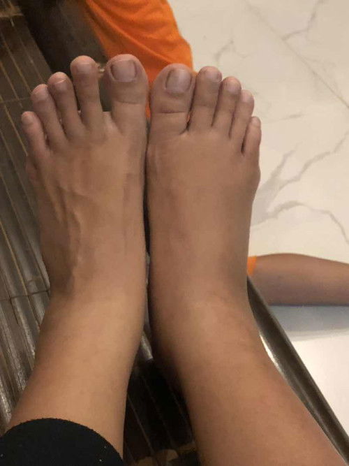 35 weeks, kaki bengkak 1 wajar atau engga ya bunda