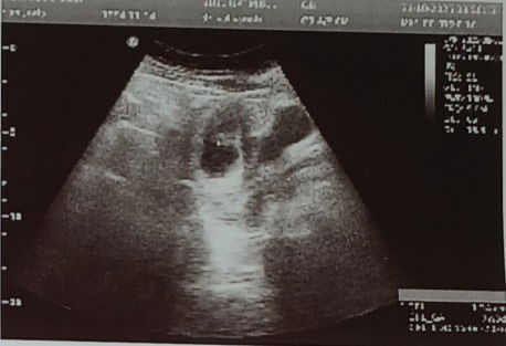 Ini usg 7 minggu tapi ko itu gambar nya begitu ada yang ngerti lihat hasil usg gak? Dari gambar nya