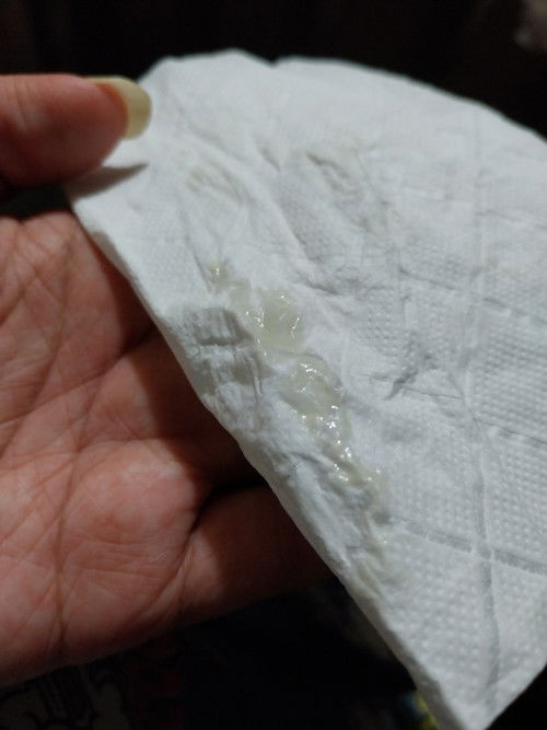 ตกขาวขุ่นๆ37+3